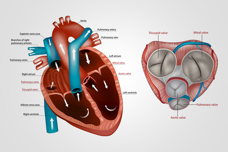 Heart Valves - Causes of Blockage (mitral & aortic Stenosis), Treatment & Valve Replacement
